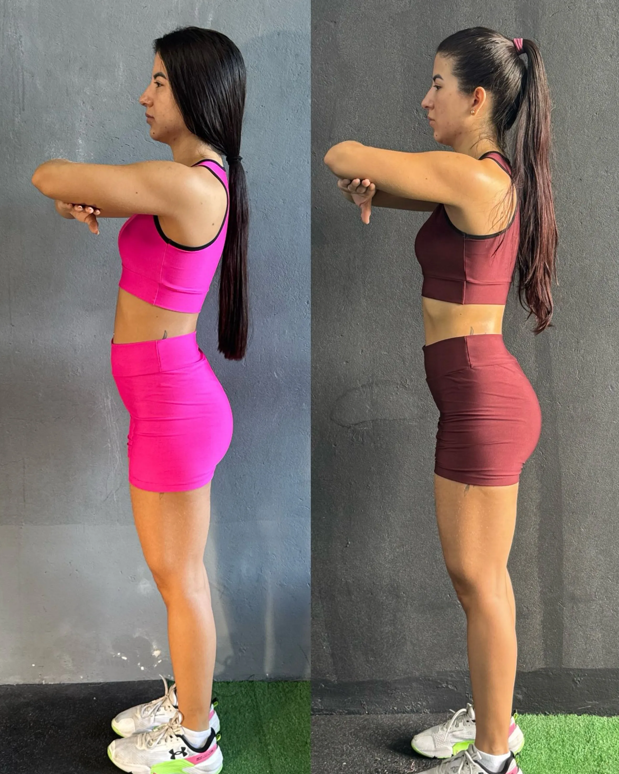 Transformação Mylena — antes e depois